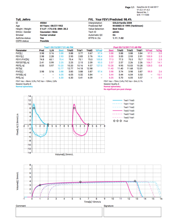 EasyOne Air Report