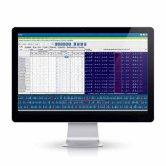 HSCRIBE Holter Analysis System - Baxter - New
